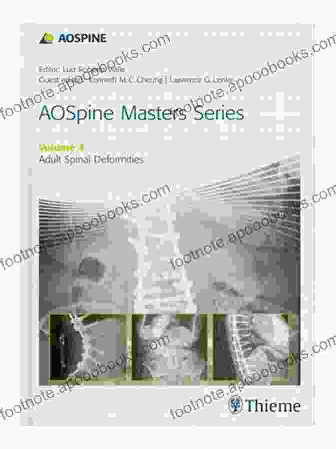 Aospine Masters Volume Adult Spinal Deformities Book Cover AOSpine Masters Volume 4: Adult Spinal Deformities