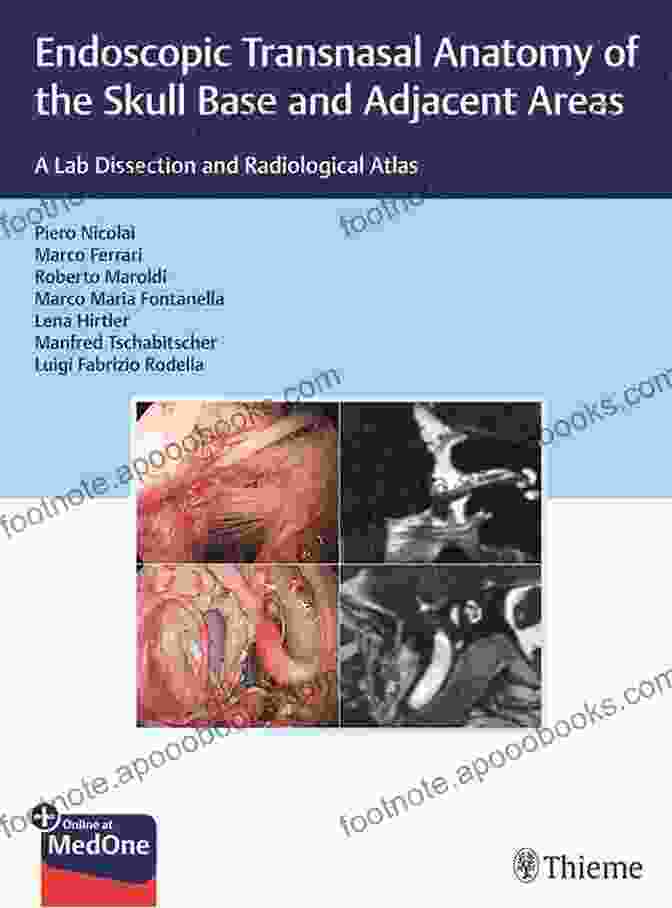 Lab Dissection And Radiological Atlas: The Ultimate Guide To Understanding The Human Body Endoscopic Transnasal Anatomy Of The Skull Base And Adjacent Areas: A Lab Dissection And Radiological Atlas