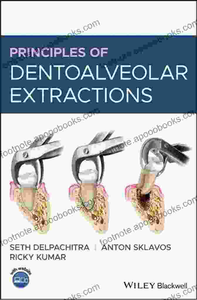 Principles Of Dentoalveolar Extractions By Catherine Silas Principles Of Dentoalveolar Extractions Catherine Silas