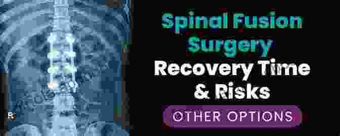 Table Of Potential Risks And Complications Of Minimally Invasive Spine Surgery Decision Making For Minimally Invasive Spine Surgery