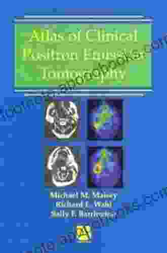 Atlas Of Clinical Positron Emission Tomography