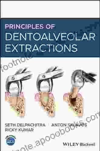 Principles Of Dentoalveolar Extractions Catherine Silas